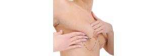 Breast Surgery Breast Surgery