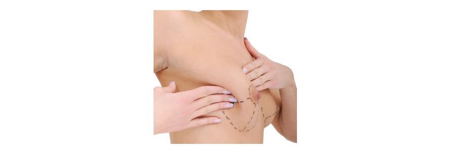 Breast Surgery Breast Surgery